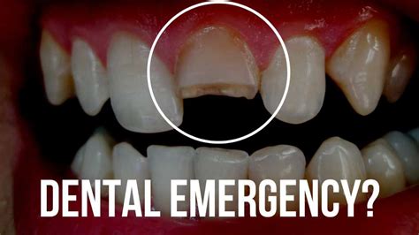 emergency dentist west kelowna